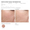 TOUCHBeauty Hot/Cool Sonic Vibration Facial & Eye Massager (Skin Rejuvenator) TB-1589